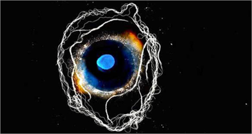 artwork by Susan Aldworth: long black background with a central ambiguous image resembling both a human eye and a blue and yellow galaxy, around which long stringls of white float like electricity or the tendrils of a nervous system cells
