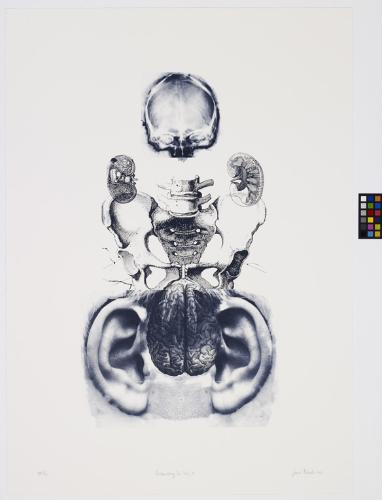 artwork by Susan Aldworth: a white print with collaged medical illustrations - at the top, the scan of a human skull, below it the black and white illustration of the end of a human spine and sacral bone, with smaller detailed illustrations of kidneys flanking it. At the bottom, a photorealistic illustration of a human brain, flanked by two disproportionately big black-and-white old photos of ears